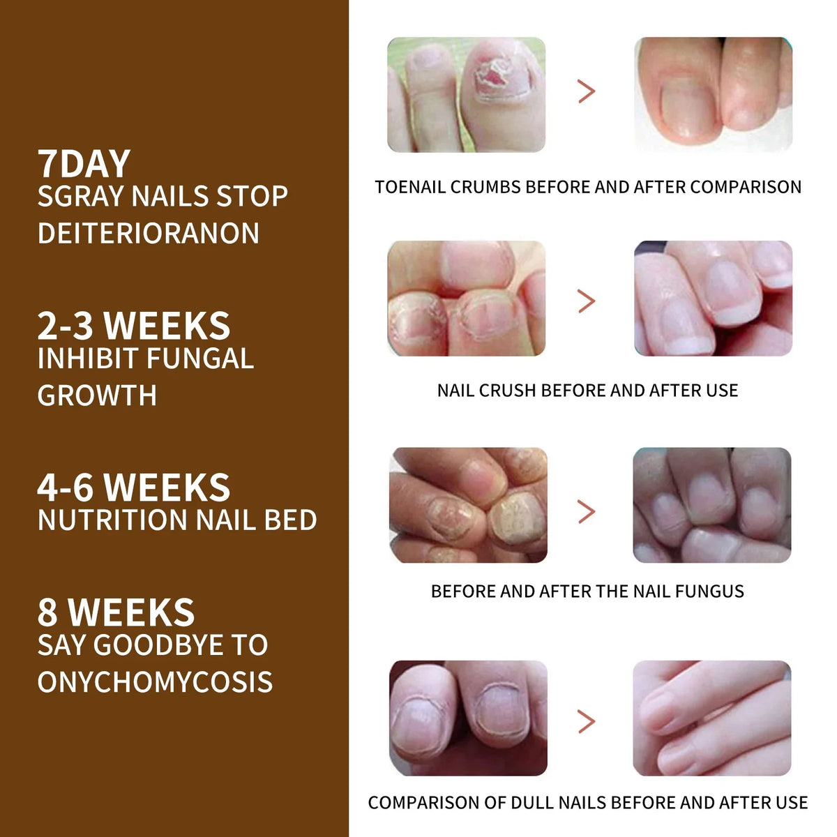 for Serum Reconstrux 3PCS Repair Growth Growth Serum, Damaged and Nails Nail Serum, Nail Nail Healing Nail Growth, Strengthening Deep Growth Nail Serum, and Growth Nail for Organic