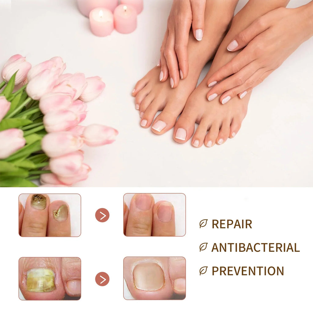 for Serum Reconstrux 3PCS Repair Growth Growth Serum, Damaged and Nails Nail Serum, Nail Nail Healing Nail Growth, Strengthening Deep Growth Nail Serum, and Growth Nail for Organic