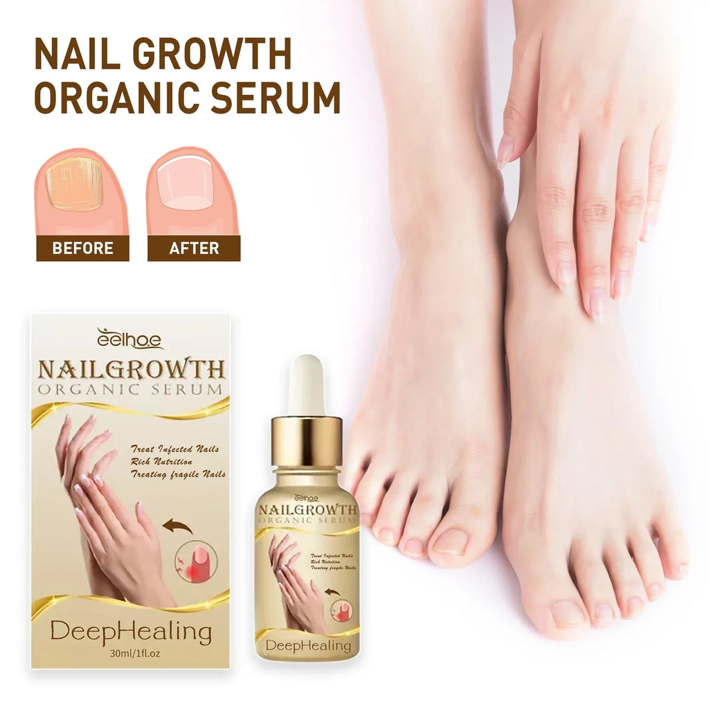 for Serum Reconstrux 3PCS Repair Growth Growth Serum, Damaged and Nails Nail Serum, Nail Nail Healing Nail Growth, Strengthening Deep Growth Nail Serum, and Growth Nail for Organic