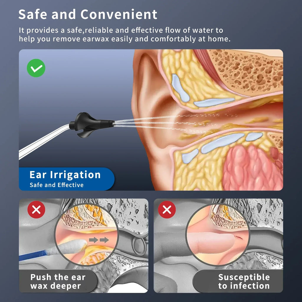 Cleaner Cleaner Ear Ear Washer Ear Cleaner Ear Electric Rechargeable Portable
