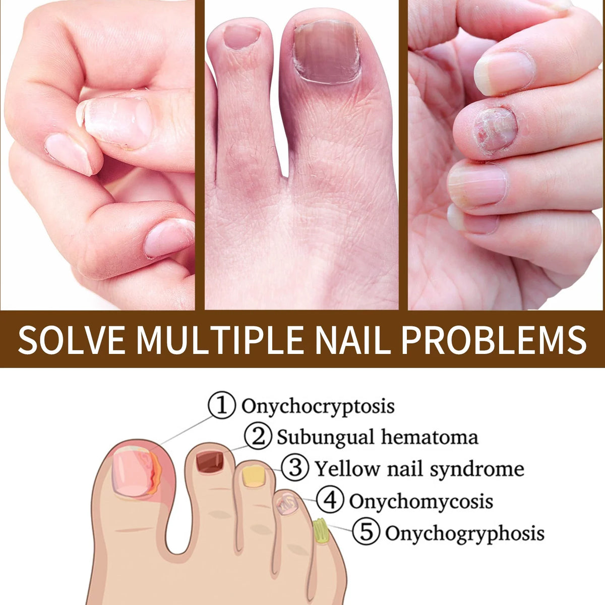 for Serum Reconstrux 3PCS Repair Growth Growth Serum, Damaged and Nails Nail Serum, Nail Nail Healing Nail Growth, Strengthening Deep Growth Nail Serum, and Growth Nail for Organic